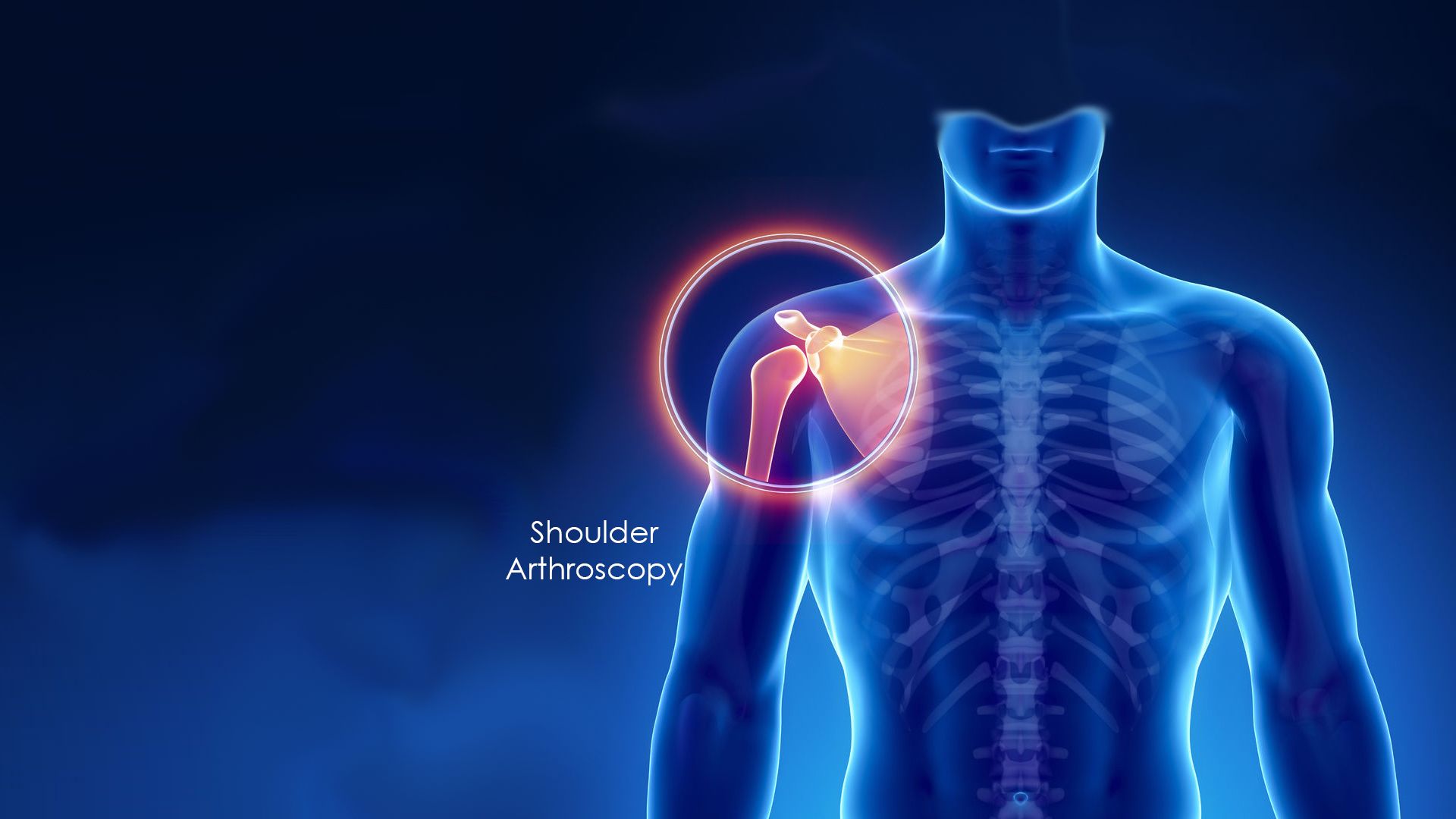 Shoulder Arthroscopy Services in Ahmedabad